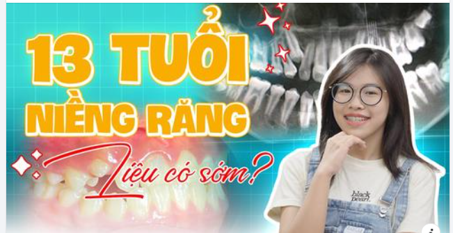 GIAI ĐOẠN 13 - 14 TUỔI NIỀNG RĂNG MÓM LIỆU CÓ NÊN?