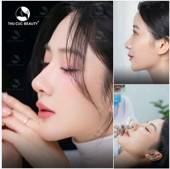  Hotgirl Như Quỳnh sở hữu visual như mơ hậu nâng mũi tại Thu Cúc