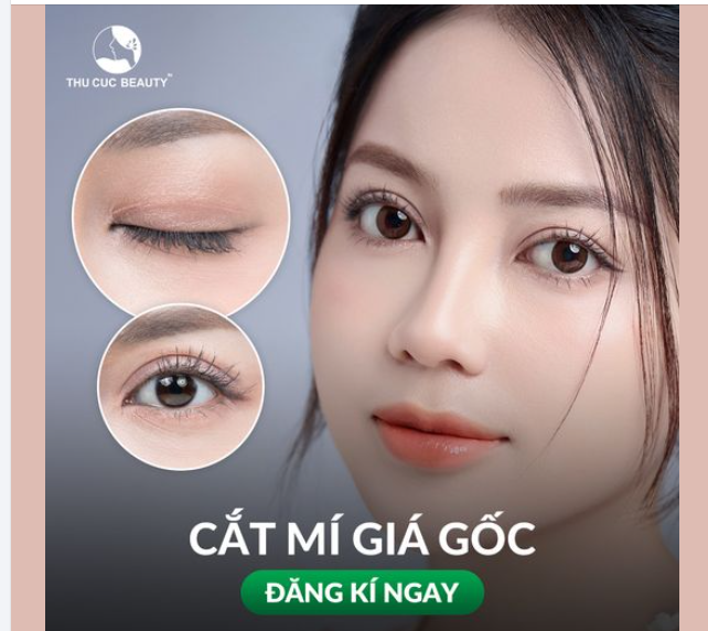 Mí lệch, mí lót  15P  2 mí rõ ràng, sắc nét