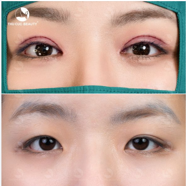 Bạn sẽ không phải băn khoăn khi nhìn vào đôi mắt này