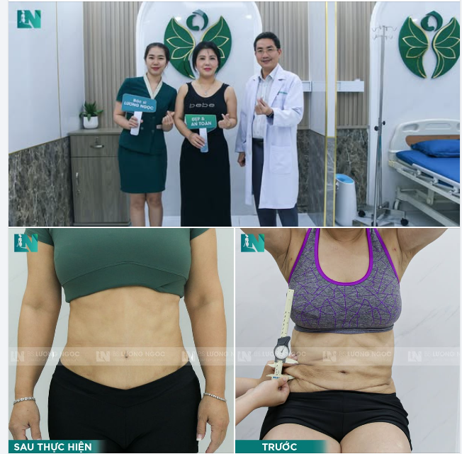 CÂU CHUYỆN “CHỮA LỖI” BỤNG LỒI LÕM