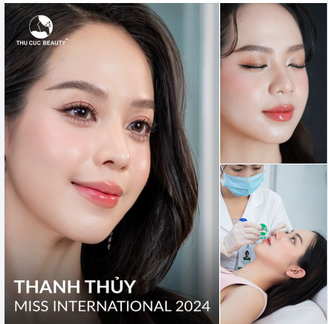 Nâng mũi Miss International '24 Tặng ngay 13.1tr tiền mặt
