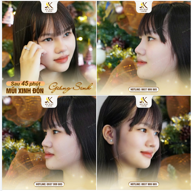 MŨI XINH ĐÓN GIÁNG SINH – RẠNG NGỜI NGÀN ÁNH NHÌN!