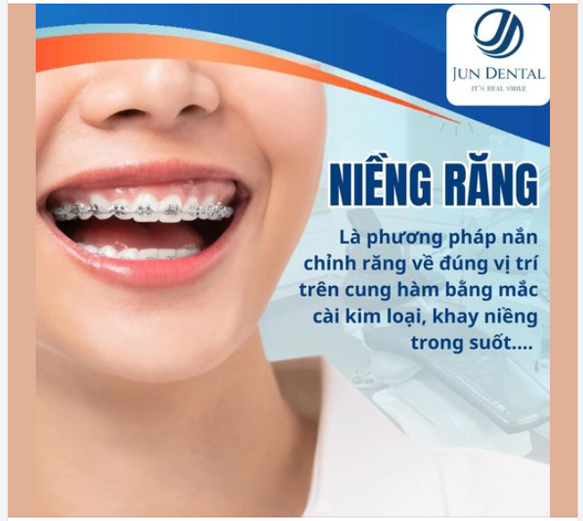 NhỮNG LỢI ÍCH BẤT NGỜ KHI NIỀNG RĂNG MÀ BẠN CHƯA BIẾT !