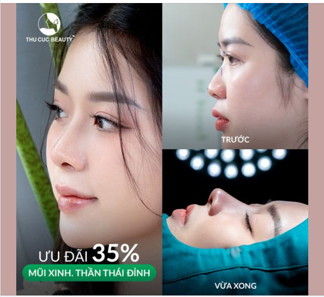 Đến TC để hô biến mọi khuyết điểm mũi tẹt, đầu mũi to