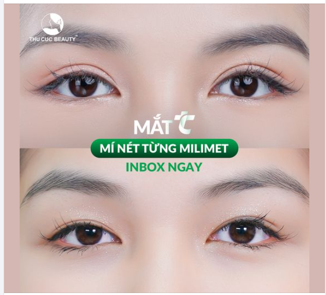 Thay diện mạo mới với đôi mắt hai mí