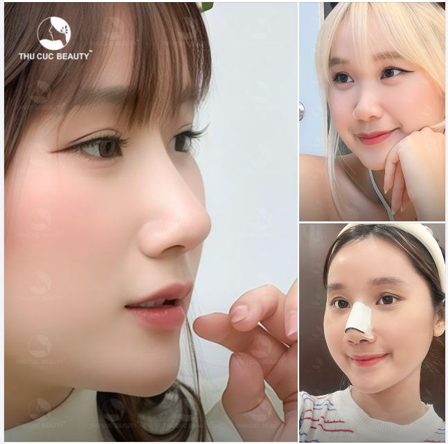 Sửa sang lại dáng mũi để kịp đón tết