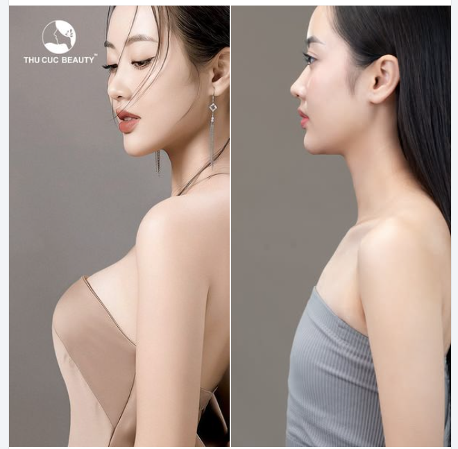 Nâng ngực Miss International '24 Tặng 31.5tr tiền mặt
