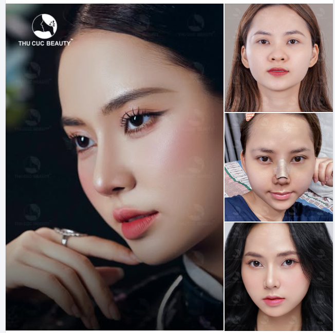 Ca sĩ Ngô Lan Hương với diện mạo cực cuốn hút sau khi nâng mũi