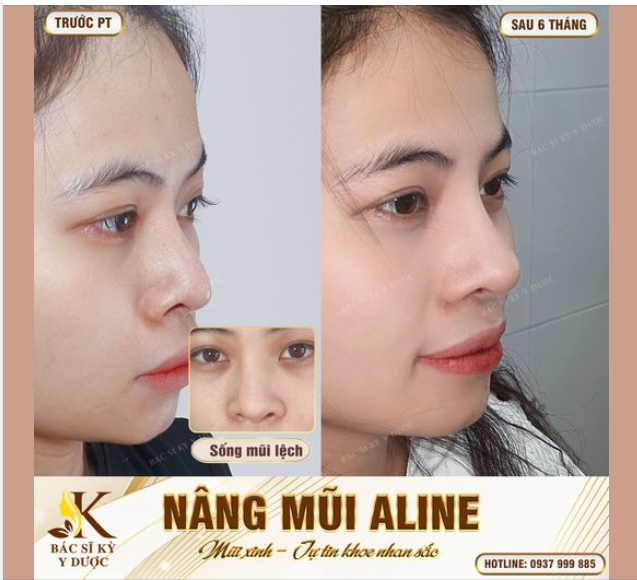 Làm đẹp ngay hôm nay để TẾT này rạng rỡ!!