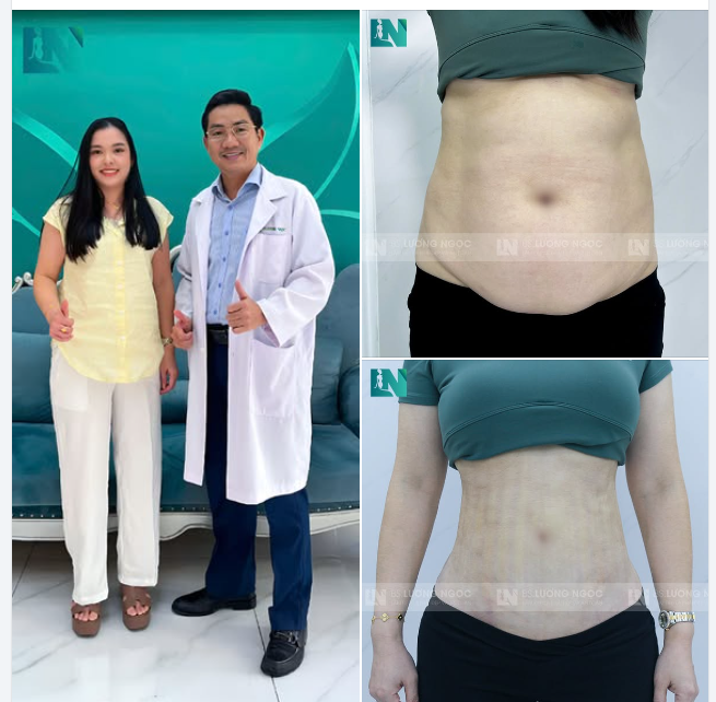 TÌM ĐÚNG PHƯƠNG PHÁP – CHẤM DỨT NỖI LO VỀ SẸO VÀ ĐAU ĐỚN