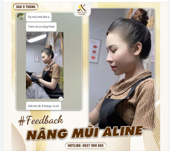 KHÁCH HÀNG “KHOE” NHAN SẮC ĐẸP “HƠN HOA” SAU NÂNG MŨI ALINE