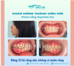 CHÀO MỪNG THÀNH VIÊN MỚI TEAM NIỀNG RĂNG SMILE ONE