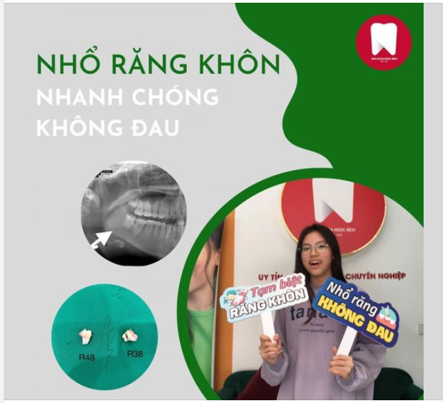 LOẠI BỎ RĂNG KHÔN - KHÔNG LO ĐAU NHỨC
