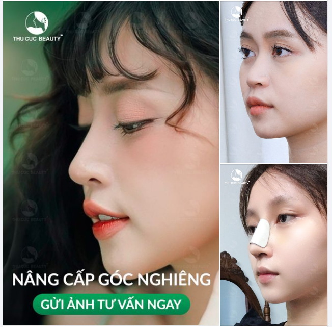 Nâng cấp góc nghiềng nâng tầm nhan sắc