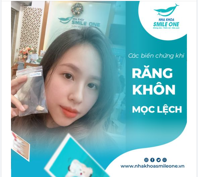 1001 BIẾN CHỨNG NGUY HIỂM KHI RĂNG KHÔN MỌC LỆCH - ĐỪNG CHỦ QUAN