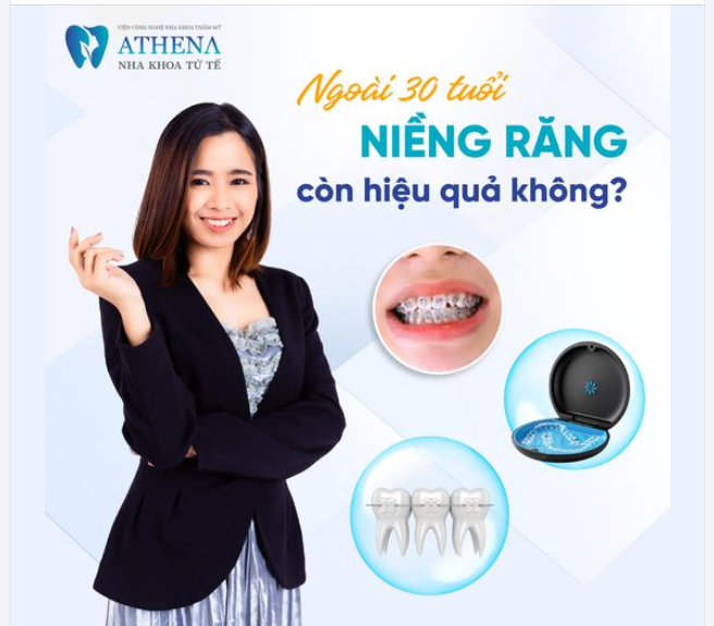 30 tuổi vẫn hoàn toàn có thể niềng răng và đạt hiệu quả tốt.