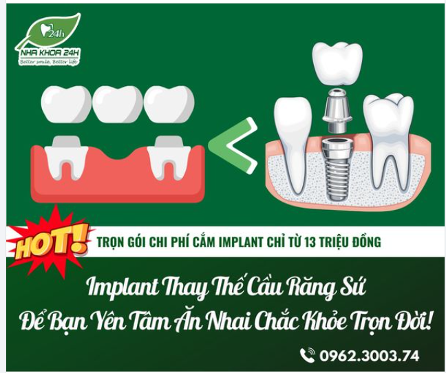 IMPLANT THAY THẾ CẦU RĂNG SỨ ĐỂ BẠN YÊN TÂM ĂN NHAI CHẮC KHOẺ TRỌN ĐỜI!