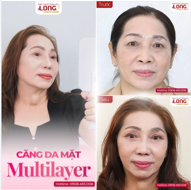 ĐẢO NGƯỢC VÒNG MÙA CUỐI NĂM  Ngắm nhìn nhan sắc cô khách U58