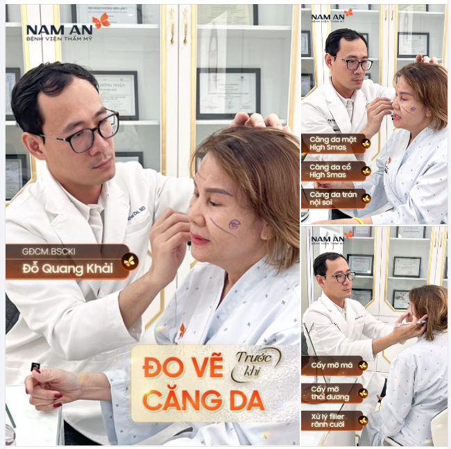 TẠI NAM AN BẮT BUỘC ĐO VẼ TRƯỚC PHẪU THUẬT CĂNG DA MẶT