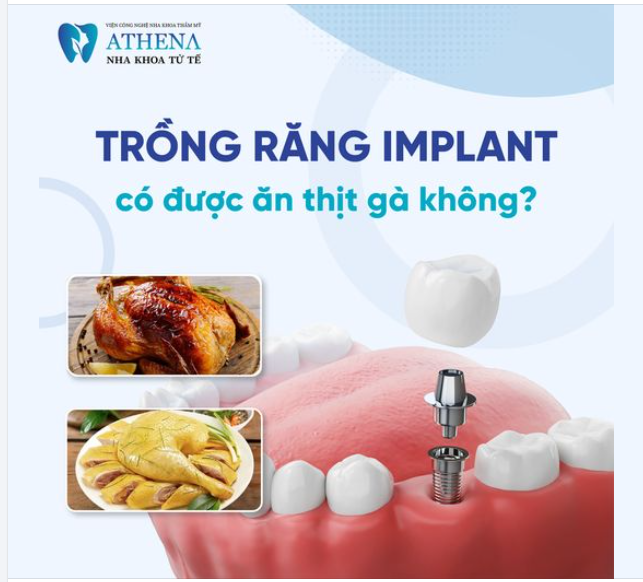 Sau khi trồng răng implant, bạn nên tránh ăn thịt gà (hoặc các loại thịt dai, cứng khác) trong khoảng thời gian đầu để vết thương lành hẳn và implant ổn định.