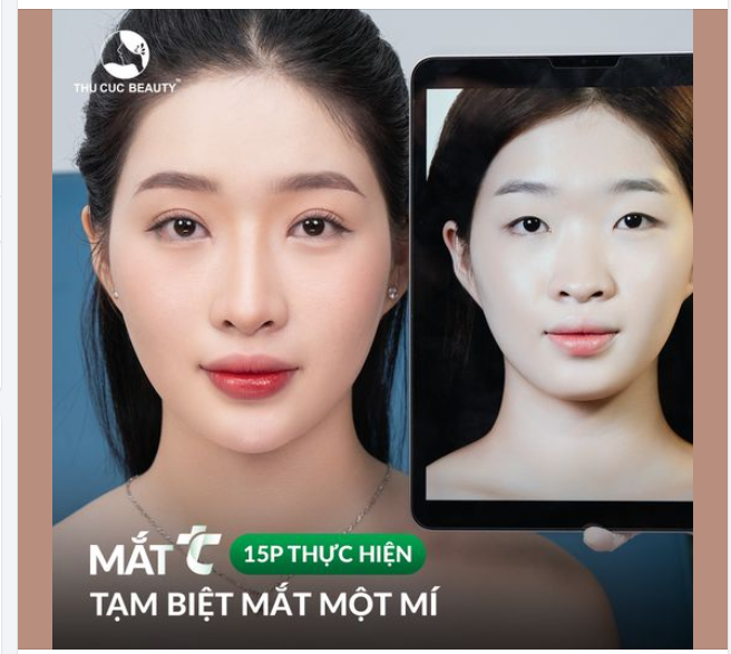 Xem post phía dưới nếp mí KH Vân Anh khác biệt hoàn toàn sau cắt mí tại Thu Cúc