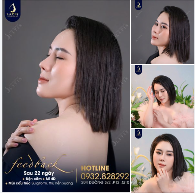 22 NGÀY BIẾN HÌNH XINH ĐẸP CHO CHỊ KHÁCH VIỆT KIỀU MỸ