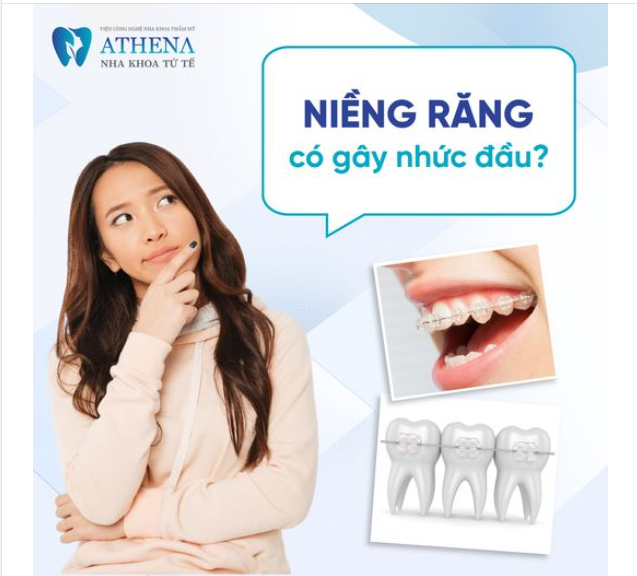 Niềng răng có gây nhức đầu không? những điều bạn nên biết