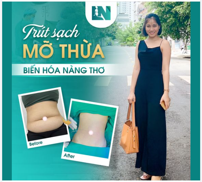 SAY BYE MỠ THỪA - CHINH PHỤC DÁNG THON, SẮC VÓC THĂNG HOA!