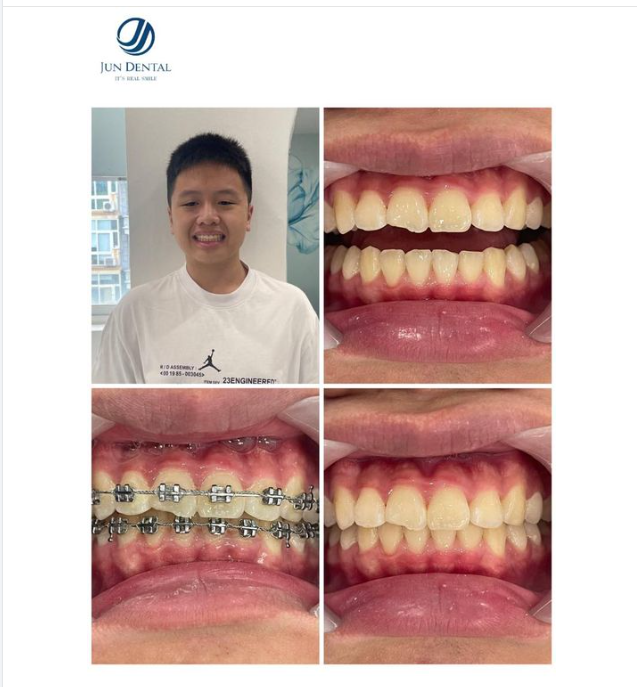 Hành trình vạn dặm đều bắt đầu từ một bước chân