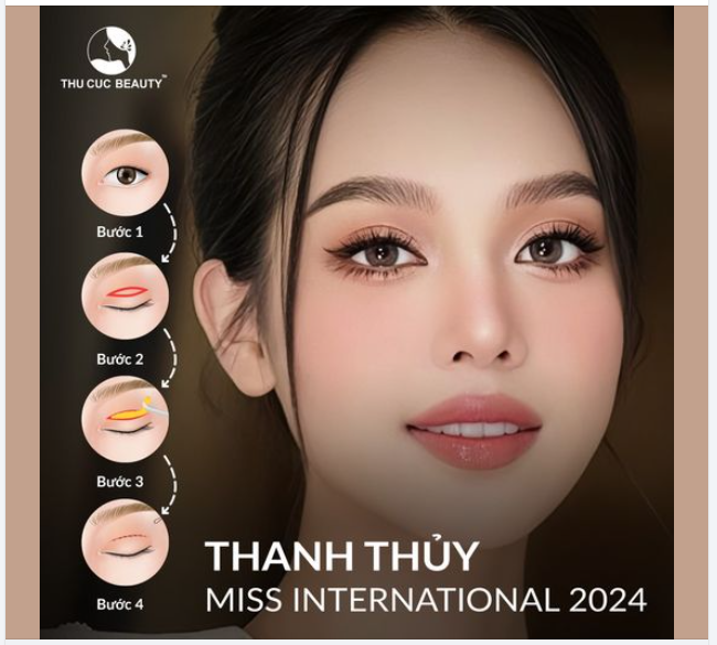 Tặng ngay 5.5tr khi Cắt mí Miss International ‘24