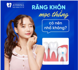 Răng khôn (hay còn gọi là răng số mọc thẳng thường khiến nhiều người phân vân: Có cần nhổ hay không?