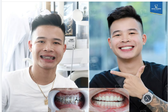 "Cuộc gặp gỡ đẹp nhất trên thế gian là gặp được phiên bản tốt hơn của chính mình"