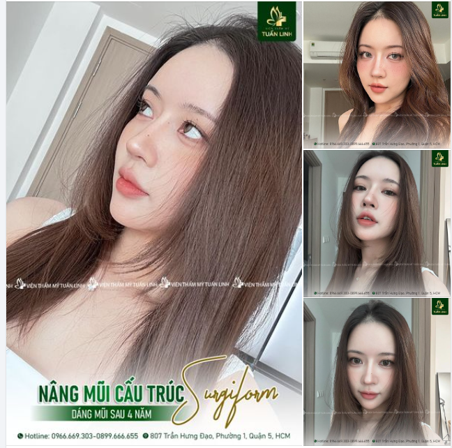 LÝ DO BẠN NÊN NÂNG MŨI TỪ BÂY GIỜ!!