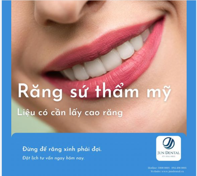 Răng Sứ Thẩm Mỹ Có Phải Lấy Cao Răng Không?