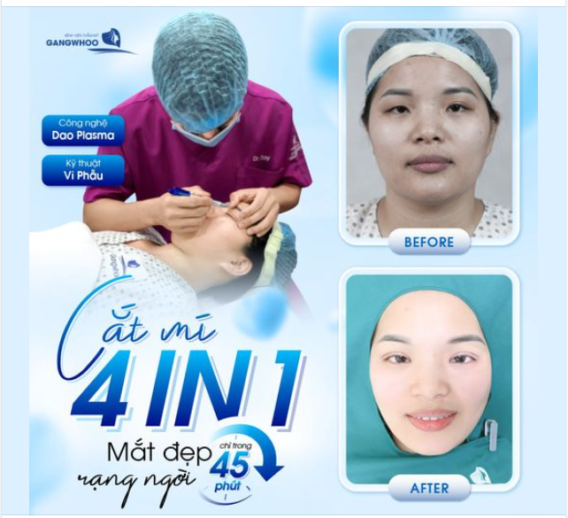 SỞ HỮU MẮT ĐẸP RẠNG NGỜI CHỈ SAU 45 PHÚT