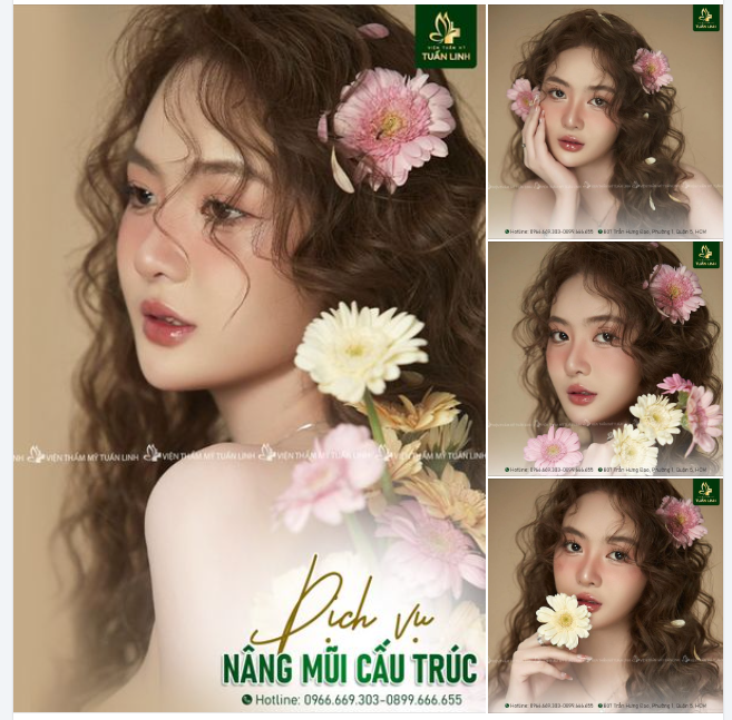 Nâng mũi cấu trúc - Dáng thiết kế - Giá siêu ƯU ĐÃI!!