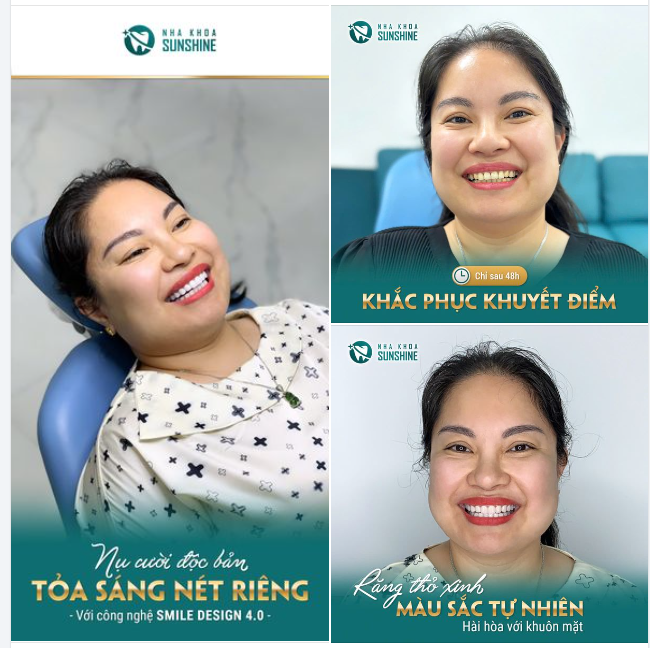 NỤ CƯỜI ĐỘC BẢN – TỎA SÁNG NÉT RIÊNG VỚI CÔNG NGHỆ SMILE DESIGN 4.0