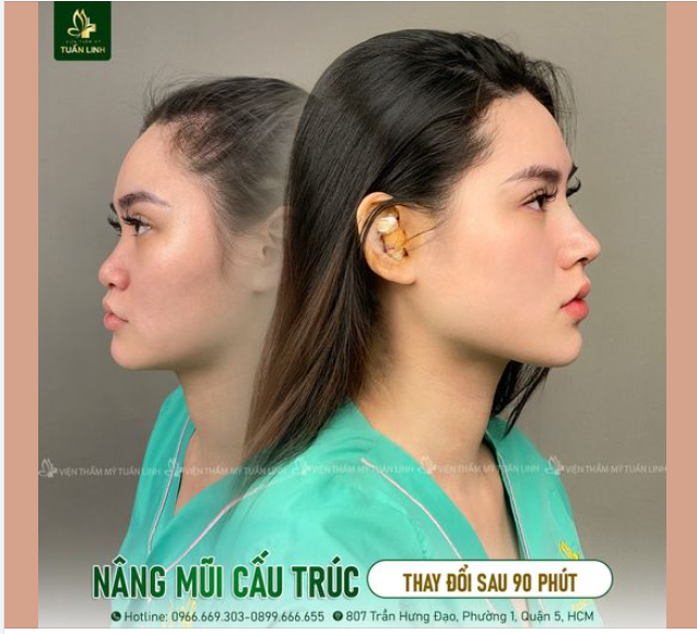 Làm đẹp ngay hôm nay để TẾT này rạng rỡ!!