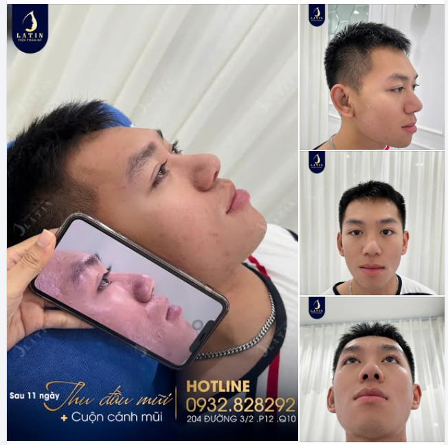 BIẾN HÌNH HOTBOY CHỈ SAU 11 NGÀY