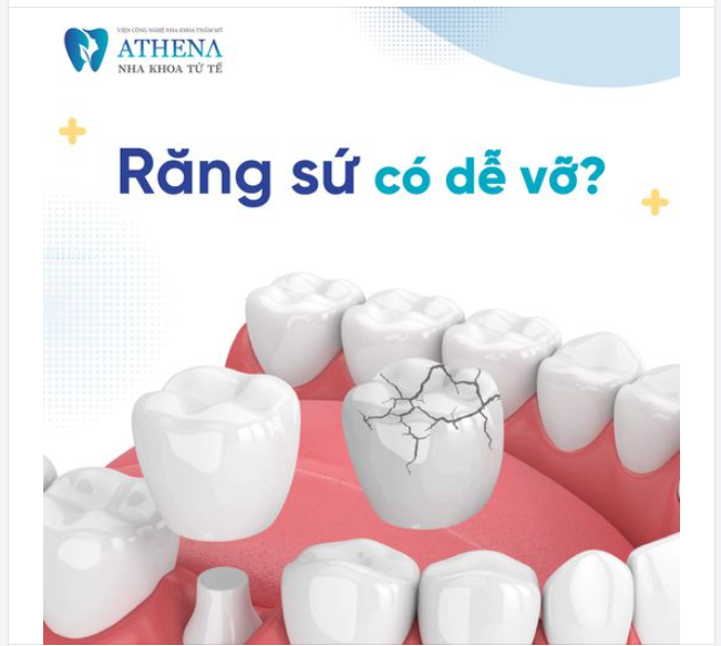 Hiện nay có rất nhiều người đã lựa chọn răng sứ để cải thiện nụ cười và sức khỏe răng miệng.