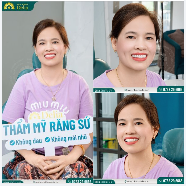 NHẬT KÝ NỤ CƯỜI DELIA: LÀM RĂNG SỨ XONG YÊU ĐỜI HƠN