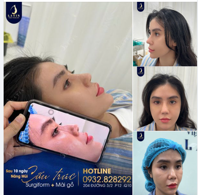 Cuối tuần khoe nhẹ dáng mũi cấu trúc 10 ngày tuổi