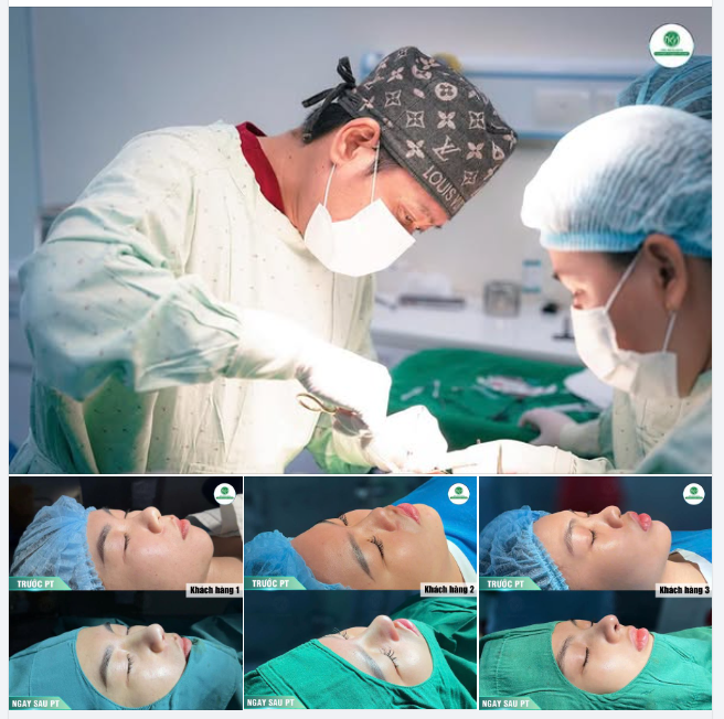 CHUYÊN MỤC KHOE MŨI ĐẸP CỦA KHÁCH HÀNG