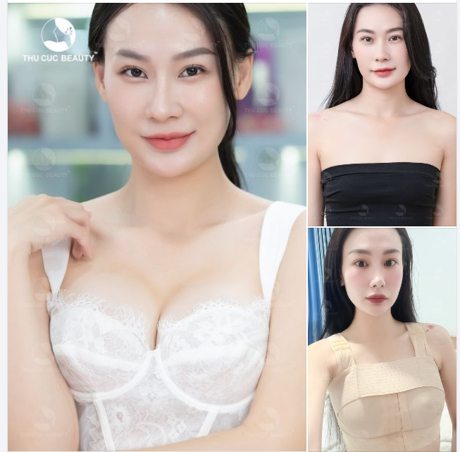 V1 lép, kém tự tin Sở hữu V1 căng mềm, tròn đầy hậu nâng ngực