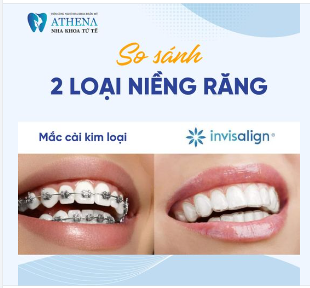 ATHENA sẽ chỉ cho bạn 1 số đặc điểm nổi bật của 2 phương pháp niềng răng nhé 