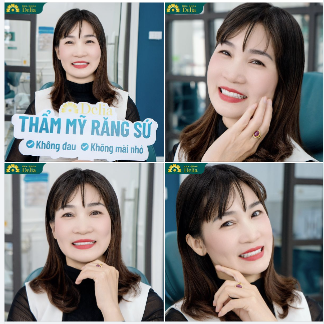 Cô giáo Phạm Thị Hải rạng rỡ trong nụ cười mới tại Nha khoa Delia