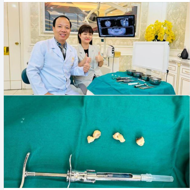 NHỔ RĂNG KHÔN MỌC NGẦM CHỈ VỚI 20 PHÚT
