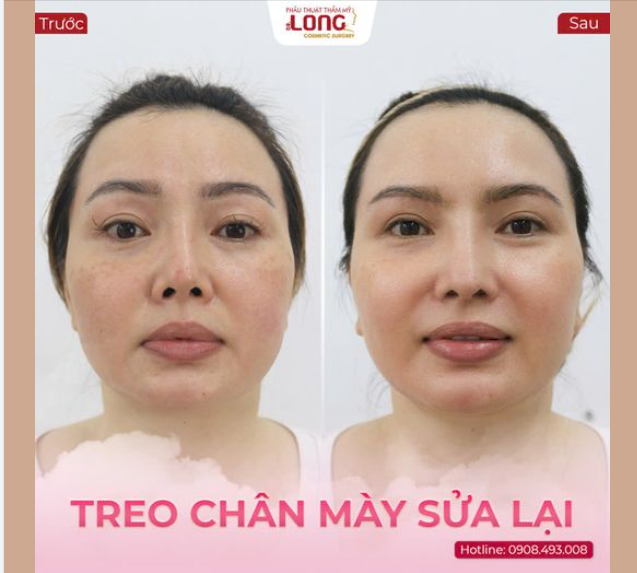 TREO MÀY CAO SANG – RẠNG THẦN THÁI