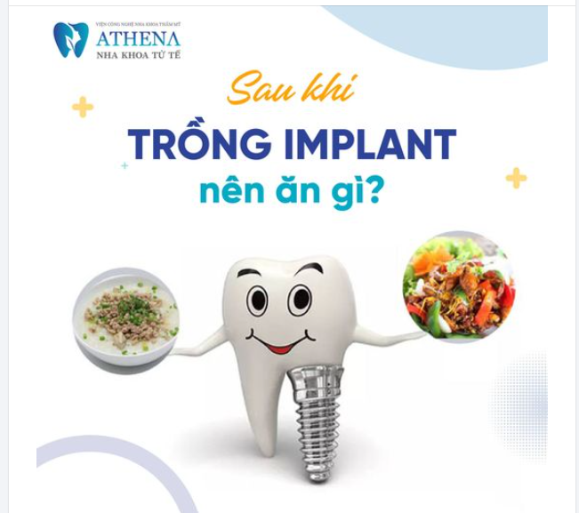 Sau khi cấy ghép Implan ăn gì để nhanh hồi phục? Bí kíp ăn uống không thể bỏ qua